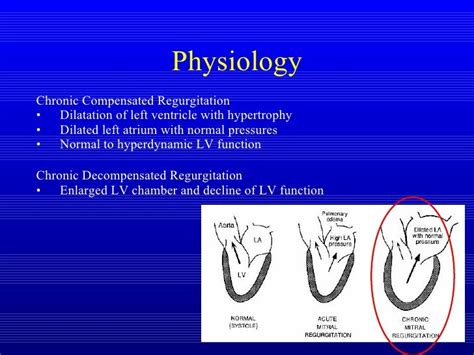 hyperdynamic lv systolic function|hyperdynamic lv systolic function meaning.